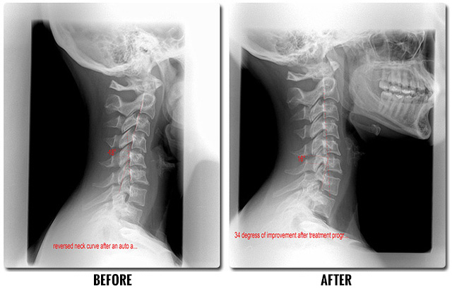 before and after auto accident